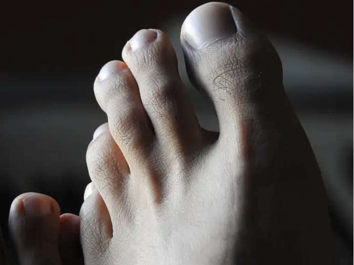 man toe toenails feet