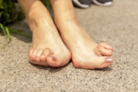 Rheumatoid Arthritis and Its Impact on the Feet